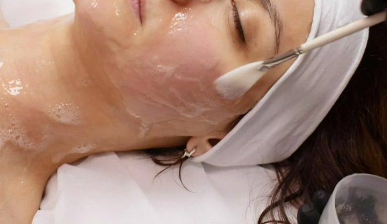 Химический пилинг кожи лица: все о популярной процедуре