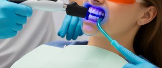 Отбеливание зубов: мифы и реальность, домашние и профессиональные методы